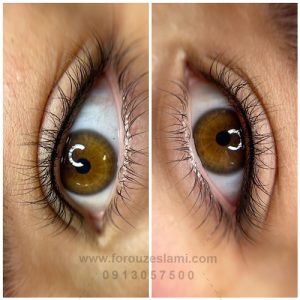 بن مژه در اصفهان