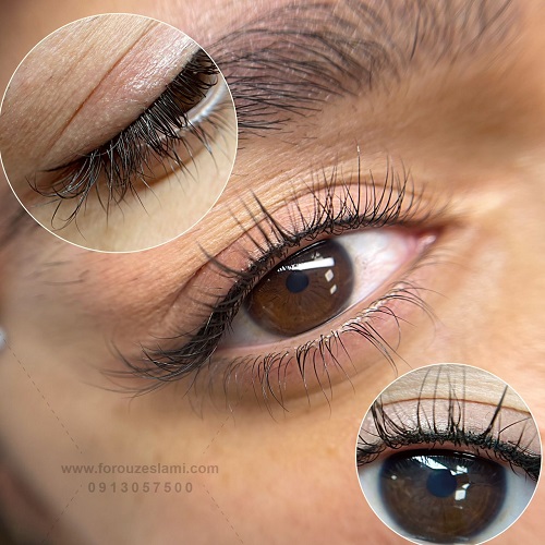 بهترین بن مژه در اصفهان