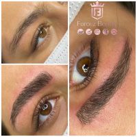 میکروبلیدینگ فیبروز اصفهان