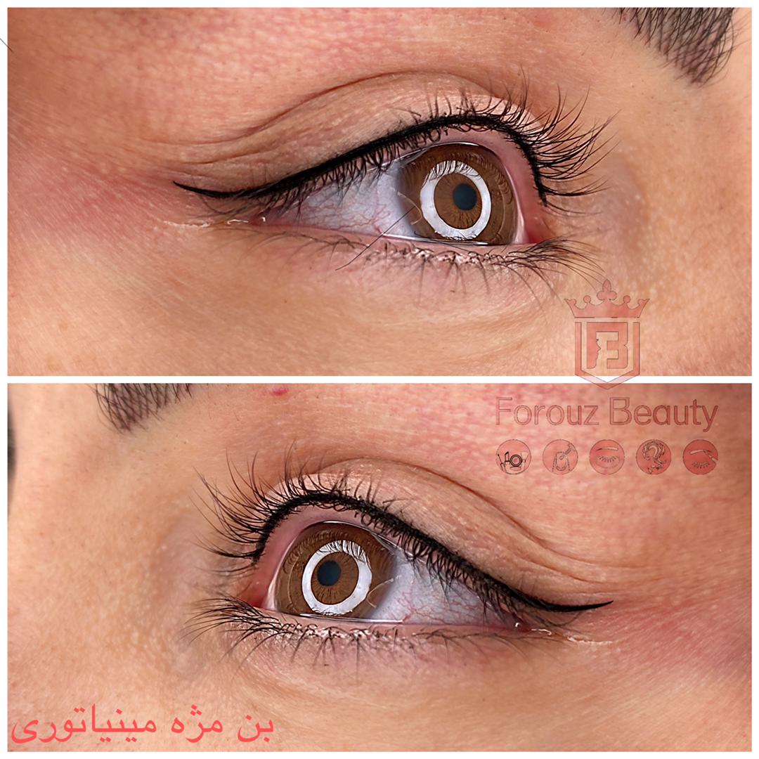 بن مژه اصفهان