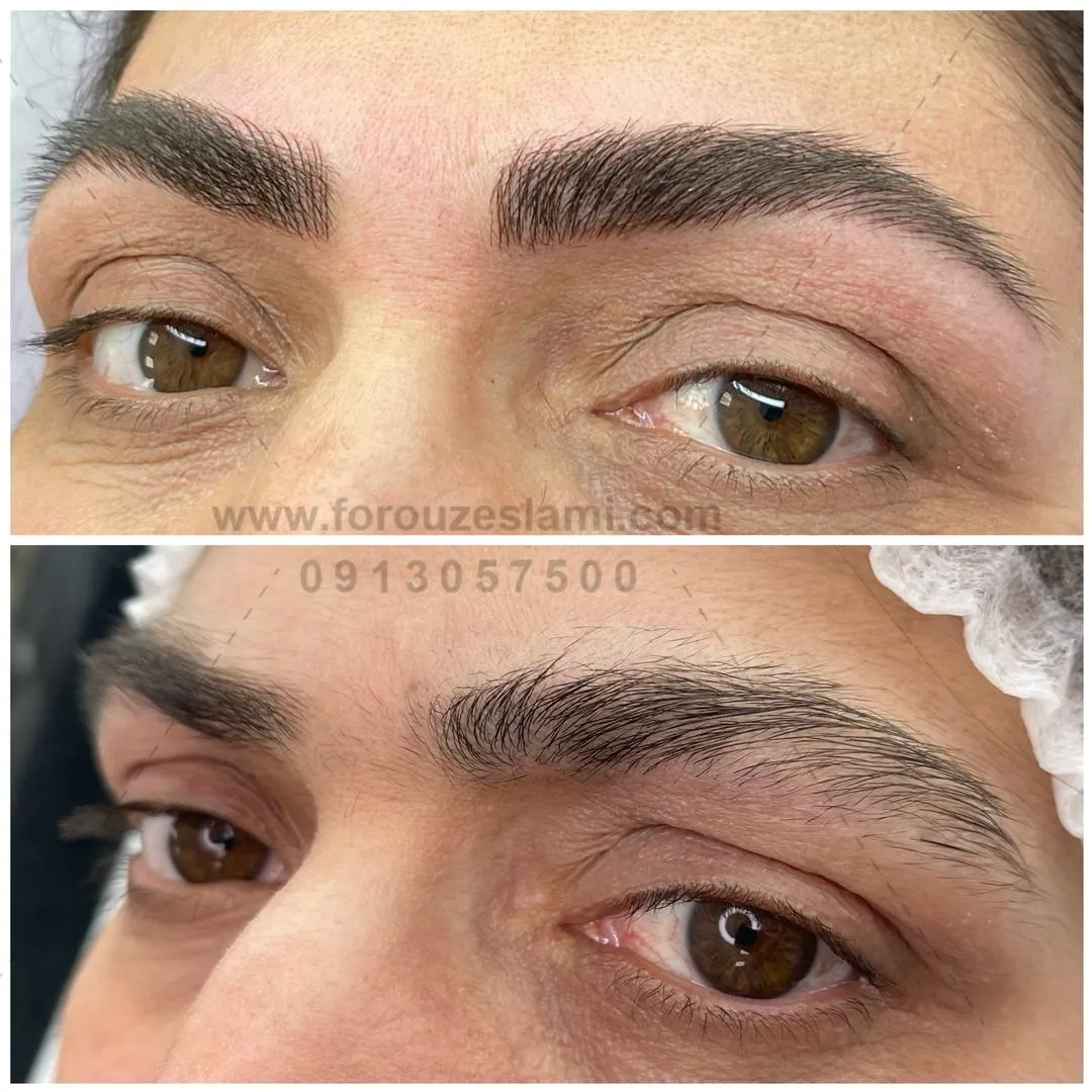 میکروبلیدینگ اصفهان