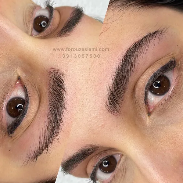 میکروبلیدینگ در اصفهان