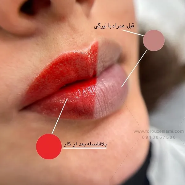 بهترین شیدینگ لب اصفهان