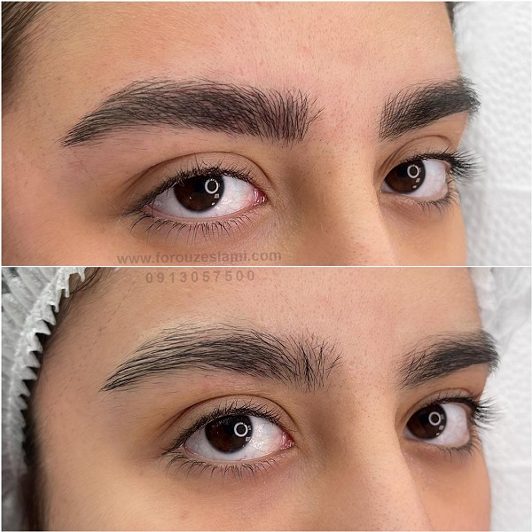 میکروبلیدینگ در اصفهان