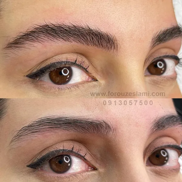 میکروبلیدینگ ابرو در اصفهان
