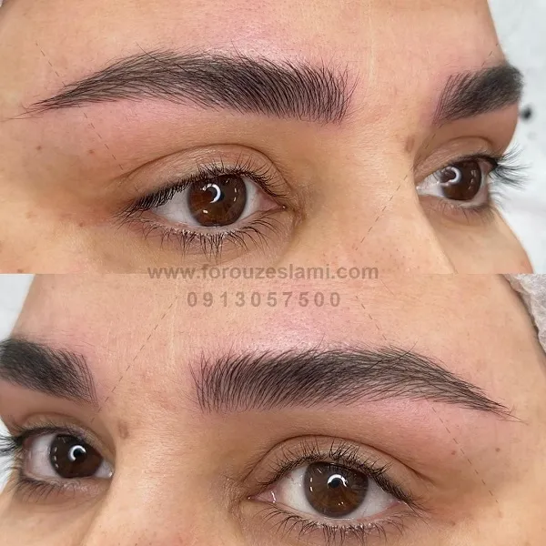 میکروبلیدینگ در اصفهان