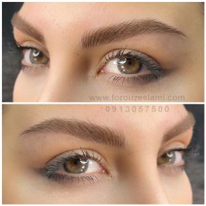 میکروبلیدینگ در اصفهان