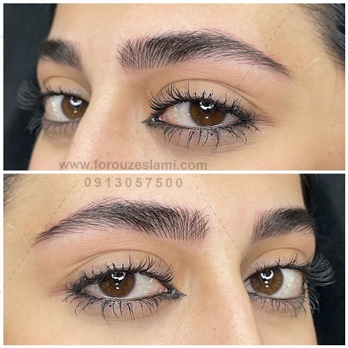 میکروبلیدینگ در اصفهان