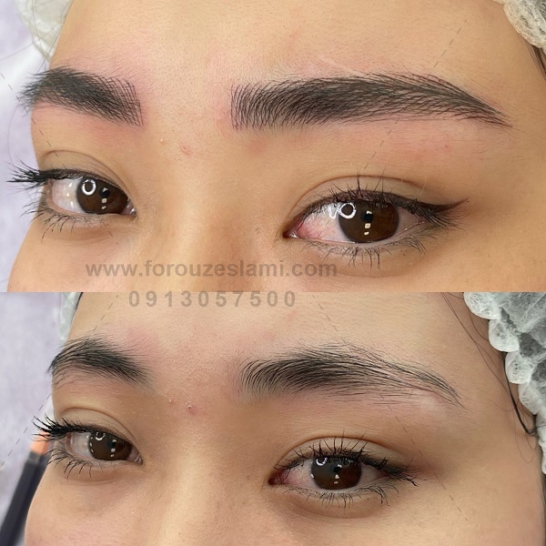 میکروبلیدینگ در اصفهان