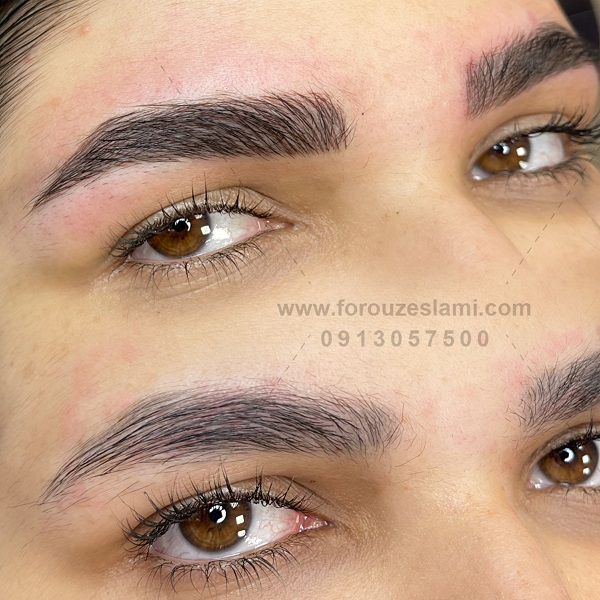 میکروبلیدینگ در اصفهان